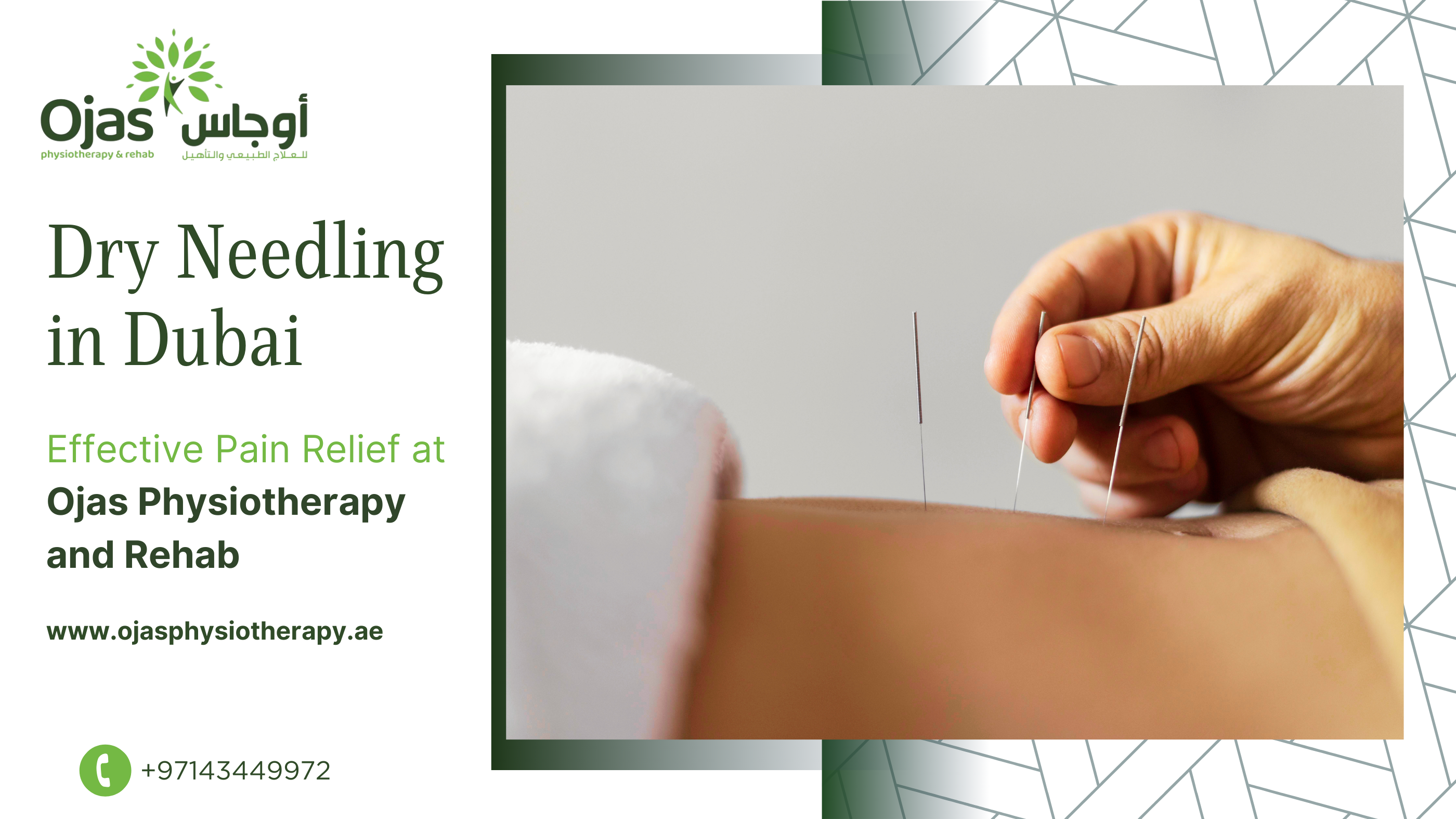 Relieve Your Pain with Dry Needling in Dubai at Ojas Physio & Rehab